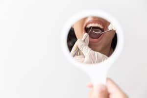 Kvinde hos tandlægen før tandblegning