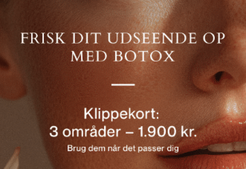 Botox klippekort