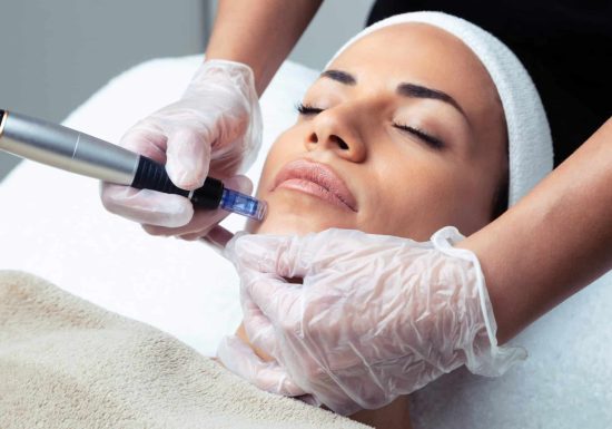 microneedling-3-scaled